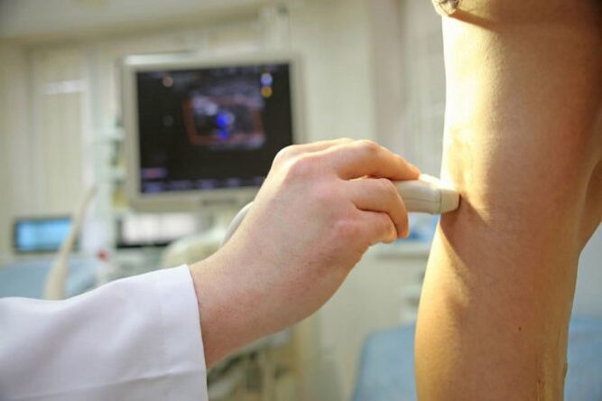 Ultrazvuk vena